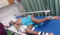 14 Tahun Melawan Penyakit, Bayu Hanya Ingin Sehat Kembali