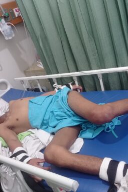 14 Tahun Melawan Penyakit, Bayu Hanya Ingin Sehat Kembali