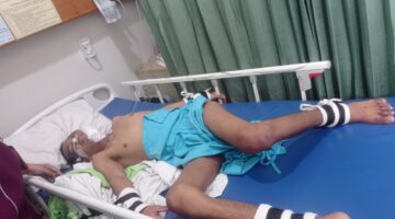 14 Tahun Melawan Penyakit, Bayu Hanya Ingin Sehat Kembali